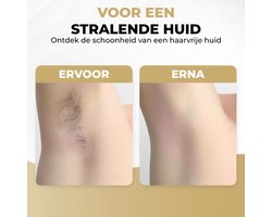 IPL - Ontharingsapparaat - Lichtontharing - IPL ontharing - Zwart & Wit - 999.999 Flitsen + Gratis Zonnebril & Scheermes