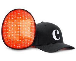 Mobiele Lasertherapie Cap voor Haargroei met 82 Rode Lichtlasers