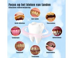 AMA® Tandsteen Verwijderaar - Tandplak Verwijderaar - Elektrische Tandsteen Verwijderaar - 20x4x20cm - Zwart