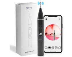 iSmile - Elektrische Sonische Tandsteen Verwijderaar met Camera - Tandplak en Tandsteen Verwijderen - Zwart